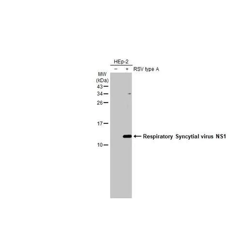 Western blot - Anti-Respiratory Syncytial virus NS1 antibody [HL2383] (AB317212)