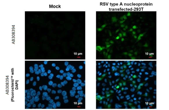 Immunocytochemistry/ Immunofluorescence - Anti-Respiratory Syncytial virus Nucleoprotein antibody [HL1246] (AB308394)