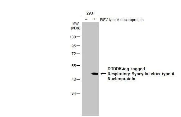 Western blot - Anti-Respiratory Syncytial virus Nucleoprotein antibody [HL1246] (AB308394)