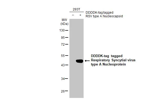 Western blot - Anti-Respiratory Syncytial virus Nucleoprotein antibody [HL1246] (AB308394)