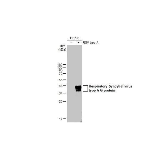 Western blot - Anti-Respiratory Syncytial virus type A G protein antibody [HL2354] (AB317208)