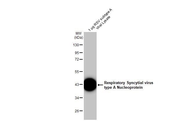 Western blot - Anti-Respiratory Syncytial virus type A Nucleoprotein antibody [HL1297] (AB308419), expandable thumbnail