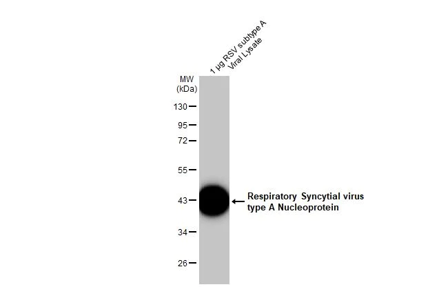 Western blot - Anti-Respiratory Syncytial virus type A Nucleoprotein antibody [HL1297] (AB308419)