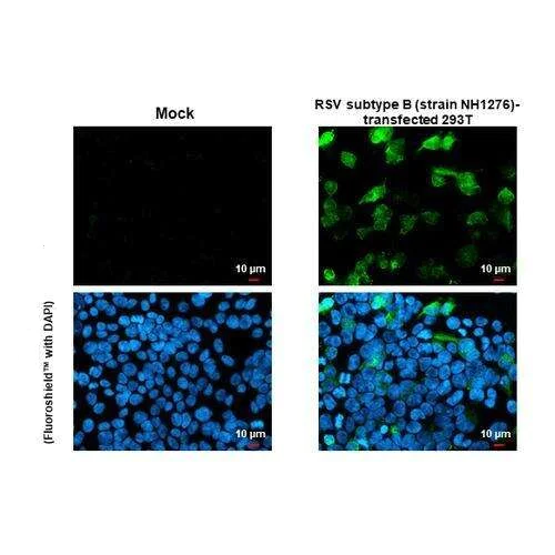 Immunocytochemistry/ Immunofluorescence - Anti-Respiratory Syncytial virus type B G protein antibody [HL1733] (AB317104)