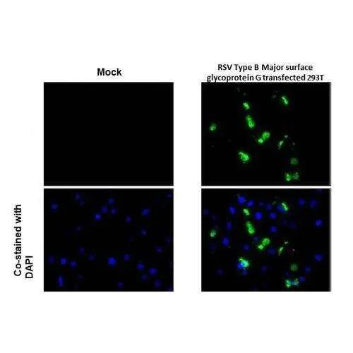 Immunohistochemistry (Formalin/PFA-fixed paraffin-embedded sections) - Anti-Respiratory Syncytial virus type B G protein antibody [HL1733] (AB317104)