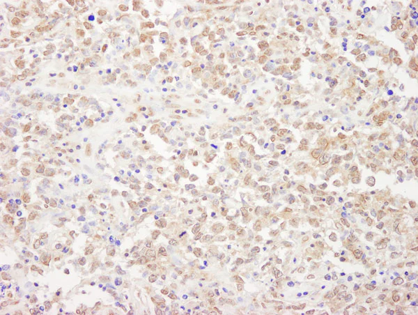 Immunohistochemistry (Formalin/PFA-fixed paraffin-embedded sections) - Anti-REST / NRSF antibody (AB70300)