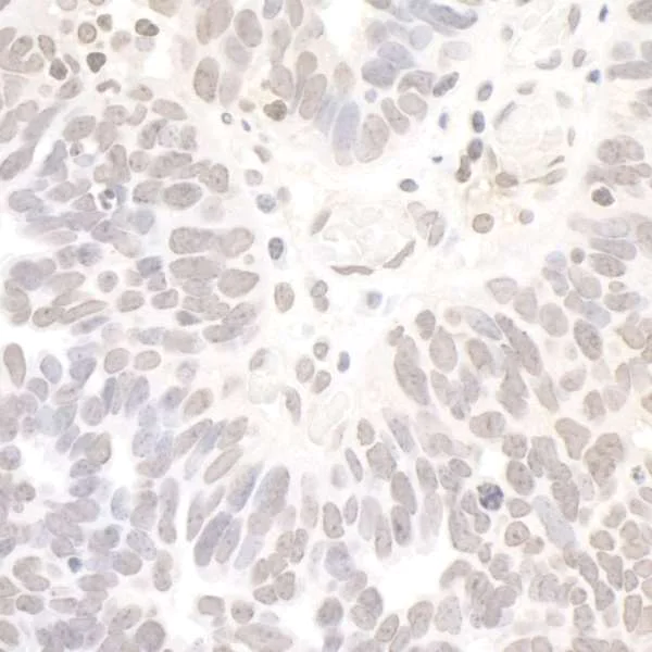Immunohistochemistry (Formalin/PFA-fixed paraffin-embedded sections) - Anti-REST / NRSF antibody (AB70300)