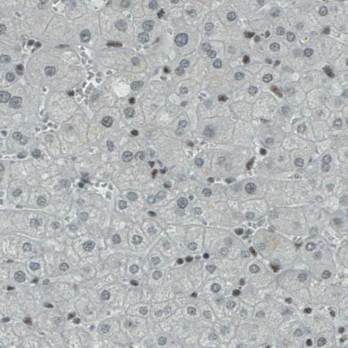 Immunohistochemistry (Formalin/PFA-fixed paraffin-embedded sections) - Anti-REST / NRSF antibody [CL0381] (AB211537)