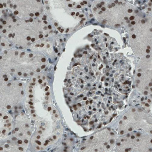 Immunohistochemistry (Formalin/PFA-fixed paraffin-embedded sections) - Anti-REST / NRSF antibody [CL0381] (AB211537)