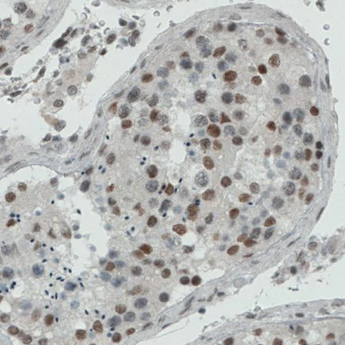Immunohistochemistry (Formalin/PFA-fixed paraffin-embedded sections) - Anti-REST / NRSF antibody [CL0381] (AB211537)