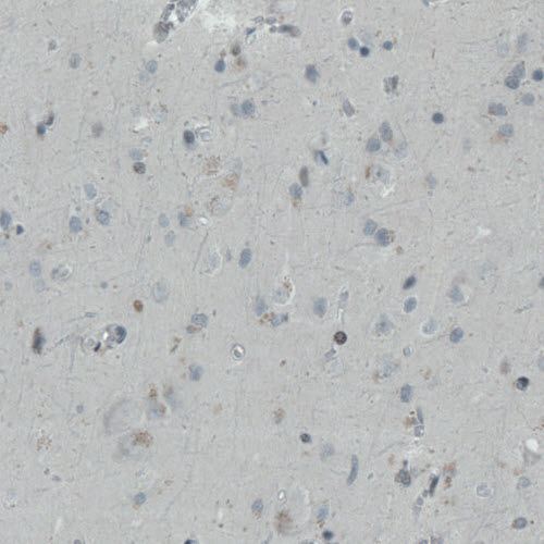 Immunohistochemistry (Formalin/PFA-fixed paraffin-embedded sections) - Anti-REST / NRSF antibody [CL0381] (AB211537)