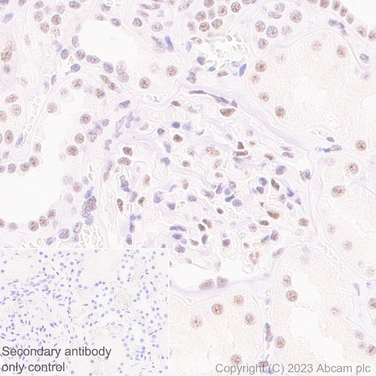 Immunohistochemistry (Formalin/PFA-fixed paraffin-embedded sections) - Anti-REST / NRSF antibody [EPR24988-29] (AB315007)