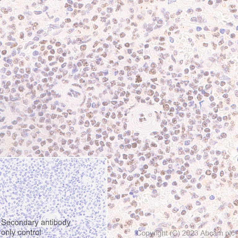 Immunohistochemistry (Formalin/PFA-fixed paraffin-embedded sections) - Anti-REST / NRSF antibody [EPR24988-29] (AB315007)