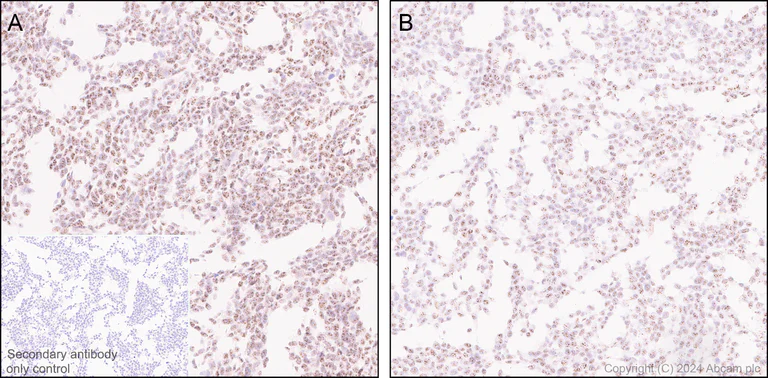 Immunohistochemistry (Formalin/PFA-fixed paraffin-embedded sections) - Anti-REST / NRSF antibody [EPR24988-29] (AB315007)