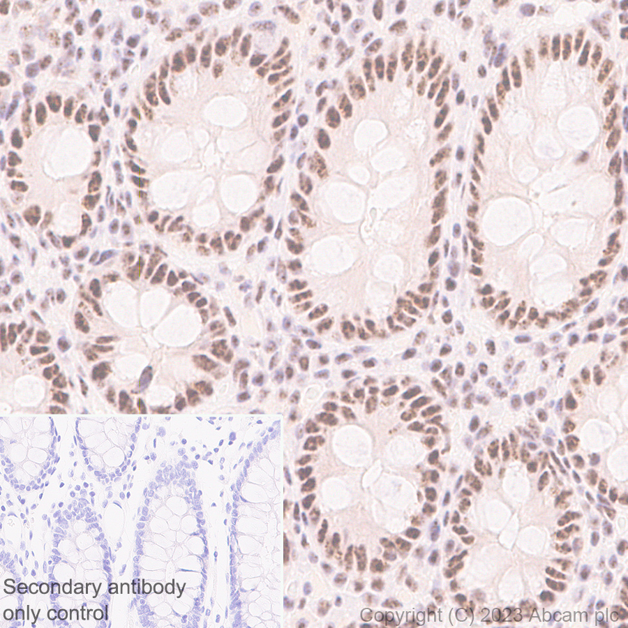 Immunohistochemistry (Formalin/PFA-fixed paraffin-embedded sections) - Anti-REST / NRSF antibody [EPR24988-29] - BSA and Azide free (AB315008), expandable thumbnail