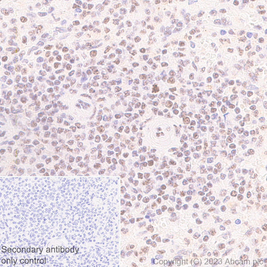 Immunohistochemistry (Formalin/PFA-fixed paraffin-embedded sections) - Anti-REST / NRSF antibody [EPR24988-29] - BSA and Azide free (AB315008), expandable thumbnail