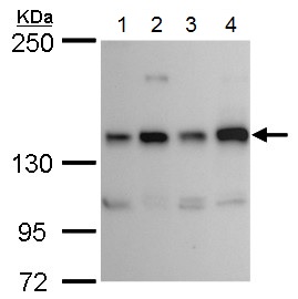 Western blot - Anti-Ret antibody (AB184189), expandable thumbnail