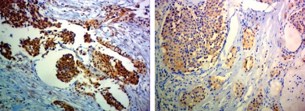 Immunohistochemistry (Formalin/PFA-fixed paraffin-embedded sections) - Anti-Ret antibody [EPR2871] (AB134100)
