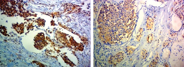 Immunohistochemistry (Formalin/PFA-fixed paraffin-embedded sections) - Anti-Ret antibody [EPR2871] (AB134100)