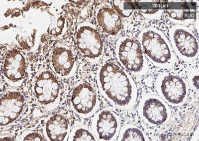 Immunohistochemistry (Formalin/PFA-fixed paraffin-embedded sections) - Anti-Ret antibody [EPR2871] (AB134100)