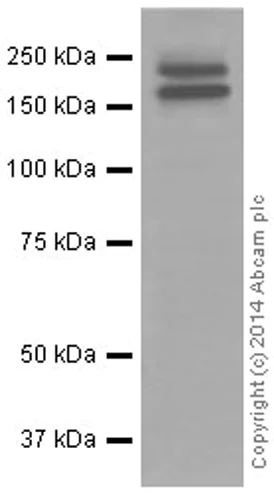 Western blot - Anti-Ret antibody [EPR2871] (AB134100)