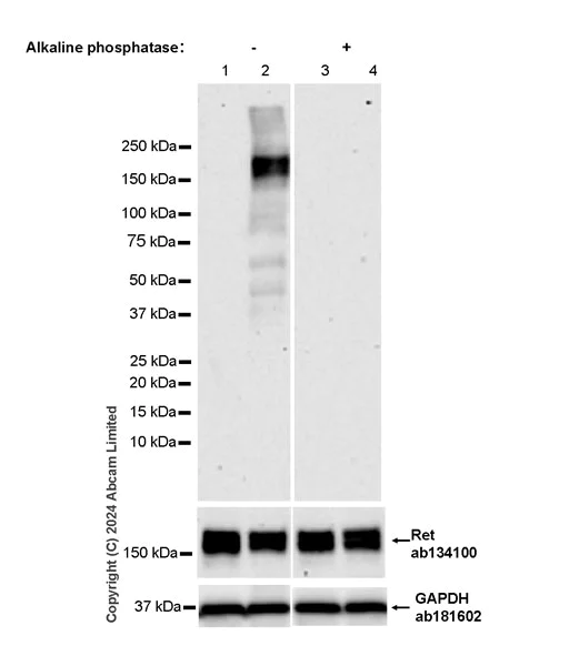 Western blot - Anti-Ret antibody [EPR2871] (AB134100)