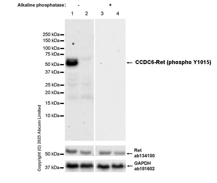 Western blot - Anti-Ret antibody [EPR2871] (AB134100)