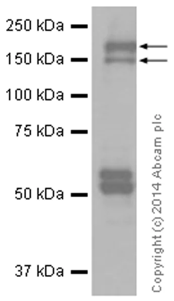Western blot - Anti-Ret antibody [EPR2871] (AB134100)
