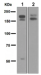 Western blot - Anti-Ret antibody [EPR2871] (AB134100)
