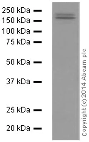 Western blot - Anti-Ret antibody [EPR2871] (AB134100)
