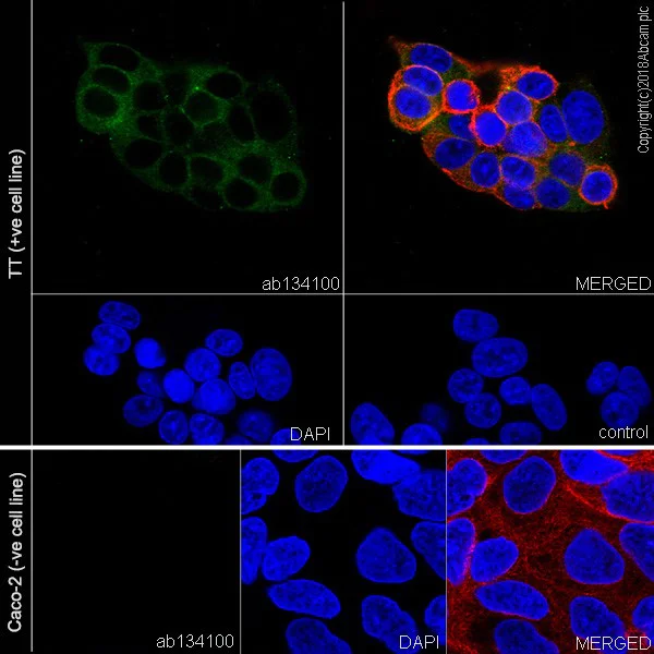 Immunocytochemistry/ Immunofluorescence - Anti-Ret antibody [EPR2871] - BSA and Azide free (AB214791)