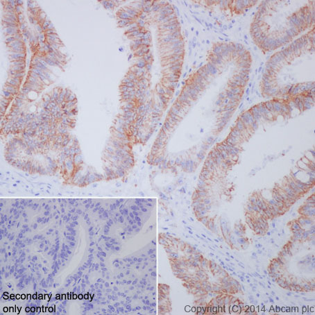 Immunohistochemistry (Formalin/PFA-fixed paraffin-embedded sections) - Anti-Ret antibody [EPR2871] - BSA and Azide free (AB214791)