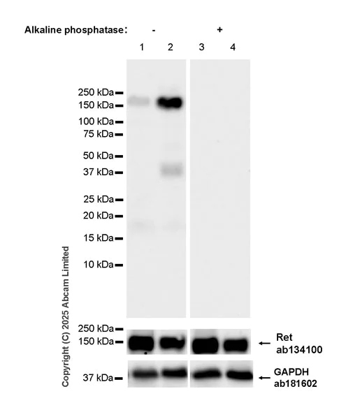 Western blot - Anti-Ret (phospho Y1015) antibody [EPR26919-93] (AB324978)