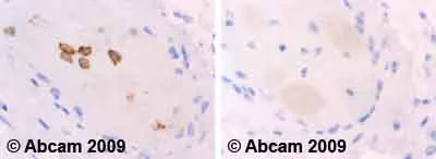 Immunohistochemistry (Formalin/PFA-fixed paraffin-embedded sections) - Anti-Ret (phospho Y1062) antibody (AB51103)