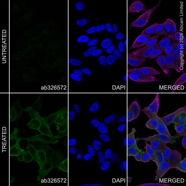 Immunocytochemistry/ Immunofluorescence - Anti-Ret (phospho Y1062) antibody [EPR30639-507] (AB326572)