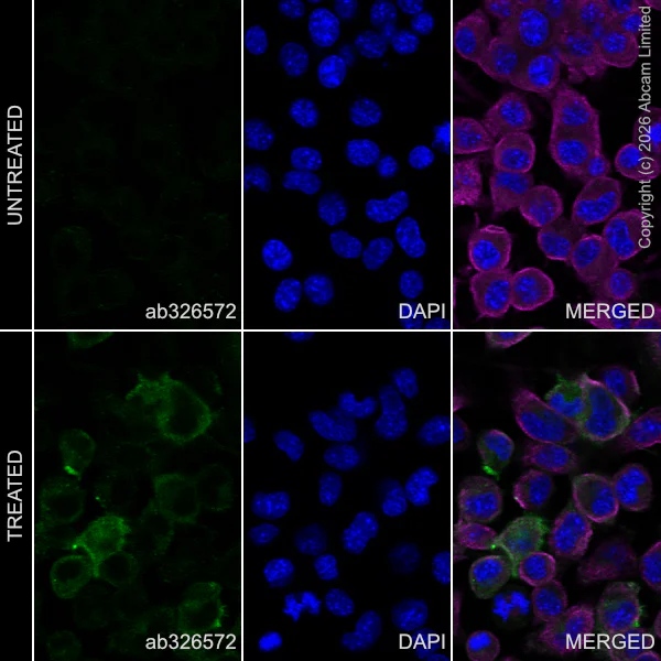 Immunocytochemistry/ Immunofluorescence - Anti-Ret (phospho Y1062) antibody [EPR30639-507] (AB326572)