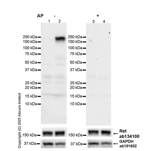 Western blot - Anti-Ret (phospho Y1062) antibody [EPR30639-507] (AB326572)