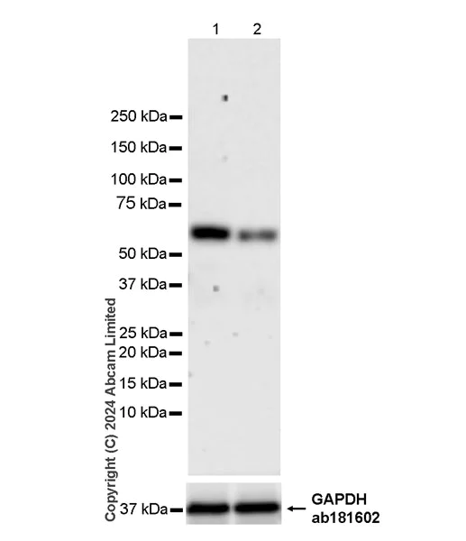 Western blot - Anti-Ret (phospho Y905) antibody [EPR26917-10] - BSA and Azide free (AB320079)