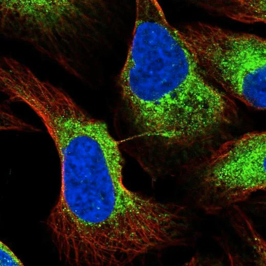 Immunocytochemistry/ Immunofluorescence - Anti-Reticulocalbin 3 antibody (AB204178)