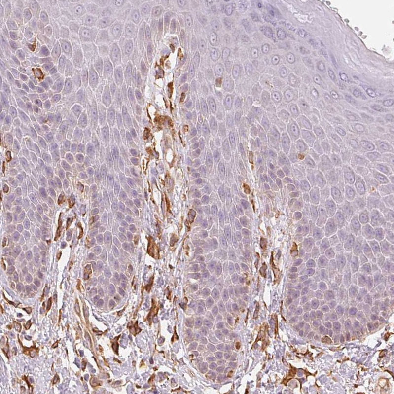 Immunohistochemistry (Formalin/PFA-fixed paraffin-embedded sections) - Anti-Reticulocalbin 3 antibody (AB204178)
