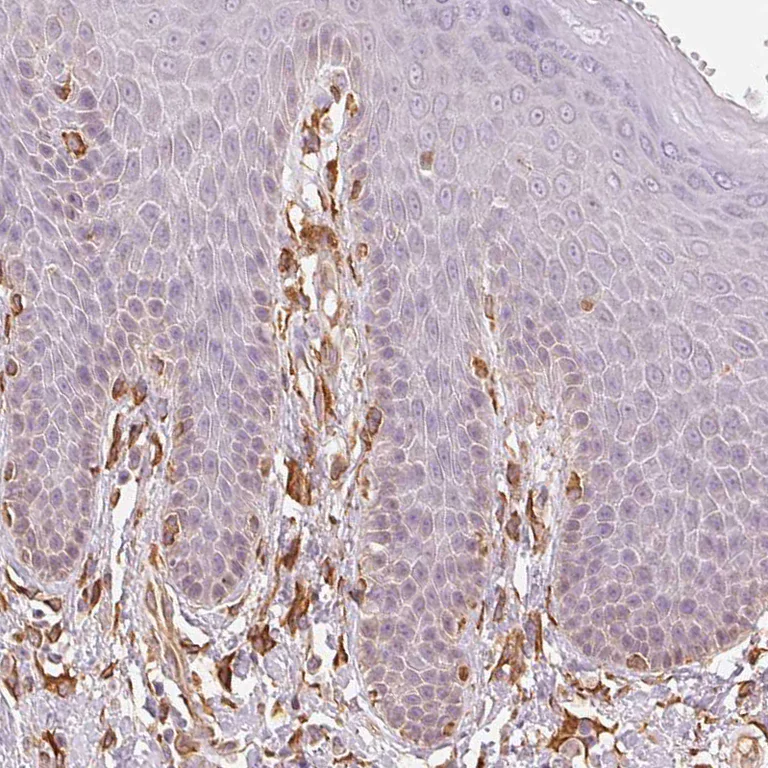 Immunohistochemistry (Formalin/PFA-fixed paraffin-embedded sections) - Anti-Reticulocalbin 3 antibody (AB204178)