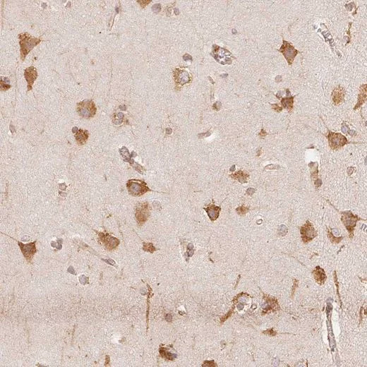 Immunohistochemistry (Formalin/PFA-fixed paraffin-embedded sections) - Anti-Reticulocalbin 3 antibody (AB204178)