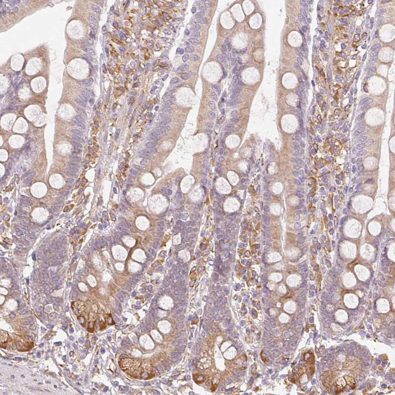 Immunohistochemistry (Formalin/PFA-fixed paraffin-embedded sections) - Anti-Reticulocalbin 3 antibody (AB204178)