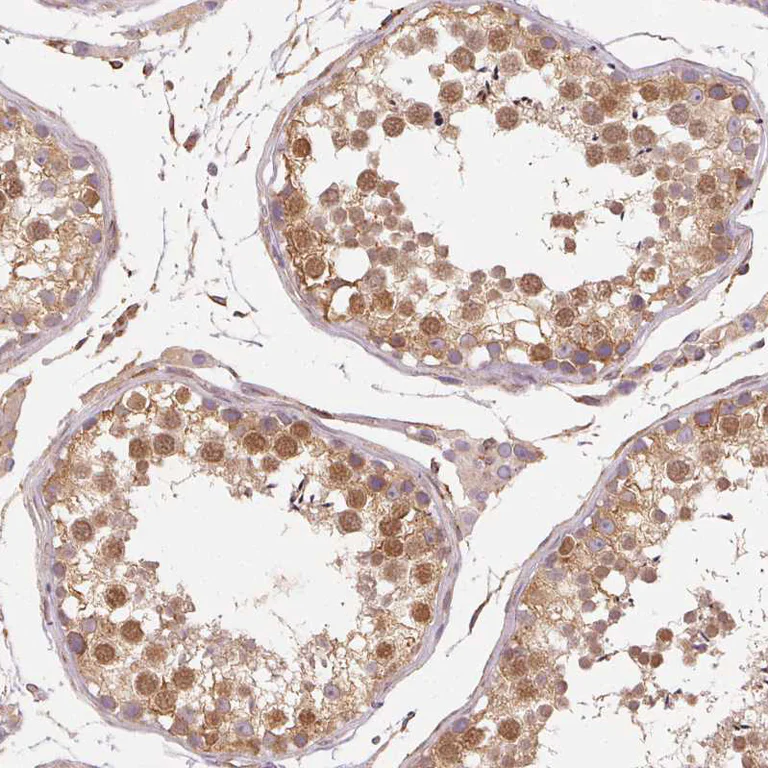 Immunohistochemistry (Formalin/PFA-fixed paraffin-embedded sections) - Anti-Reticulocalbin 3 antibody (AB204178)