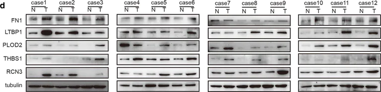 Western blot - Anti-Reticulocalbin 3 antibody (AB204178)