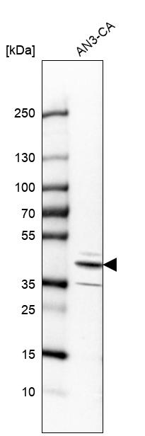 Western blot - Anti-Reticulocalbin 3 antibody (AB204178)