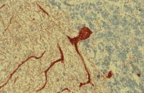 Immunohistochemistry (Formalin/PFA-fixed paraffin-embedded sections) - Anti-Reticulon 1A antibody [MON160] (AB8957)