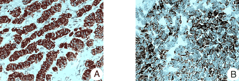 Immunohistochemistry (Formalin/PFA-fixed paraffin-embedded sections) - Anti-Reticulon 1A antibody [MON160] (AB8957)