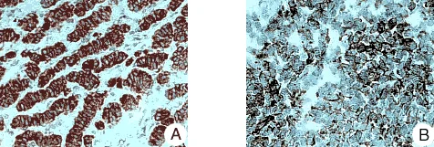 Immunohistochemistry (Formalin/PFA-fixed paraffin-embedded sections) - Anti-Reticulon 1A antibody [MON160] (AB8957)