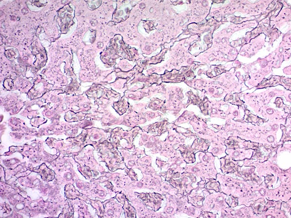 Immunohistochemistry (Formalin/PFA-fixed paraffin-embedded sections) - Reticulum Stain Kit (Modified Gomori's) (AB236473), expandable thumbnail
